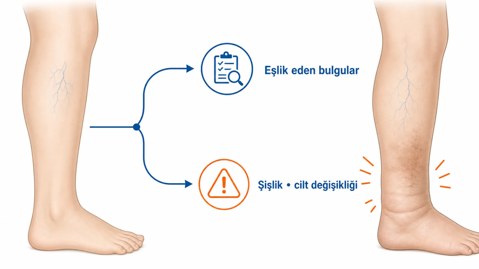 İnce damar görünümü, eşlik eden şişlik ve cilt değişikliği bulgularını değerlendirme yoluyla ayıran bacak şeması