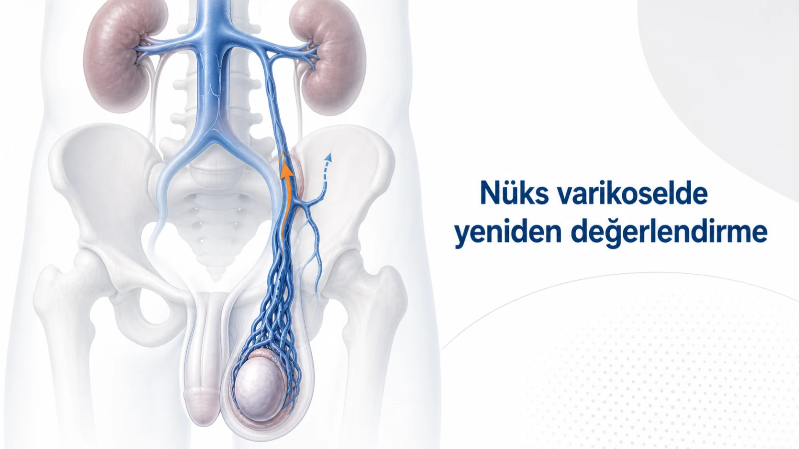 Nüks varikoselde venöz reflü ve yan damar yolunu gösteren anatomik illüstrasyon