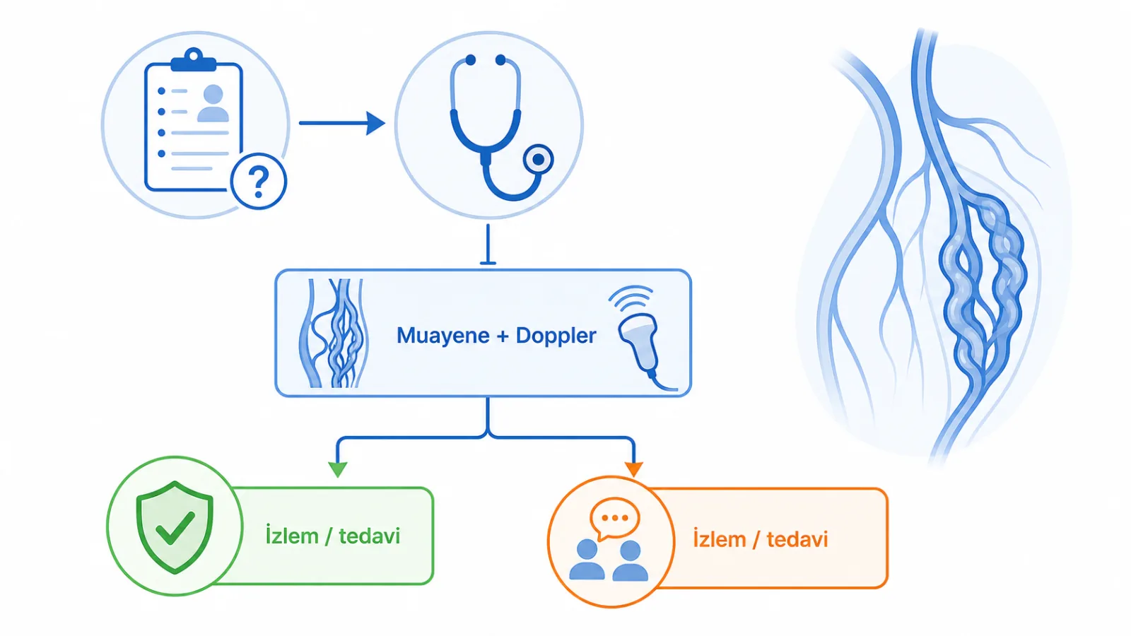 Varikosel şüphesinde semptom değerlendirmesi ve muayeneden Doppler incelemesine, oradan izlem veya tedavi kararına giden yol şeması.