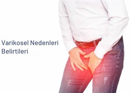 Varikosel-nedenleri-belirtileri