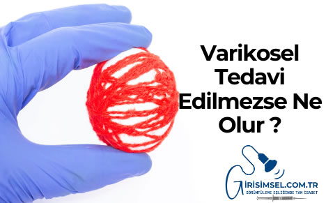 varikosel tedavi edilmelimi tedavi edilmezse ne olur
