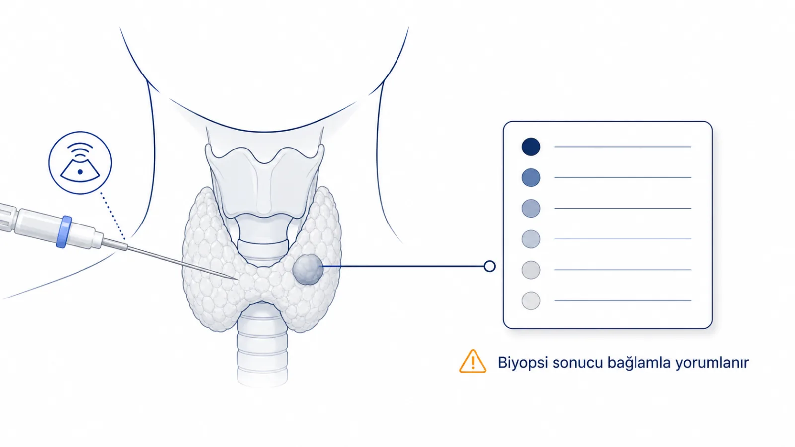 Tiroid nodülünden ince iğne biyopsisi alınmasını ve sonucun raporla birlikte değerlendirilmesini gösteren anatomik şema