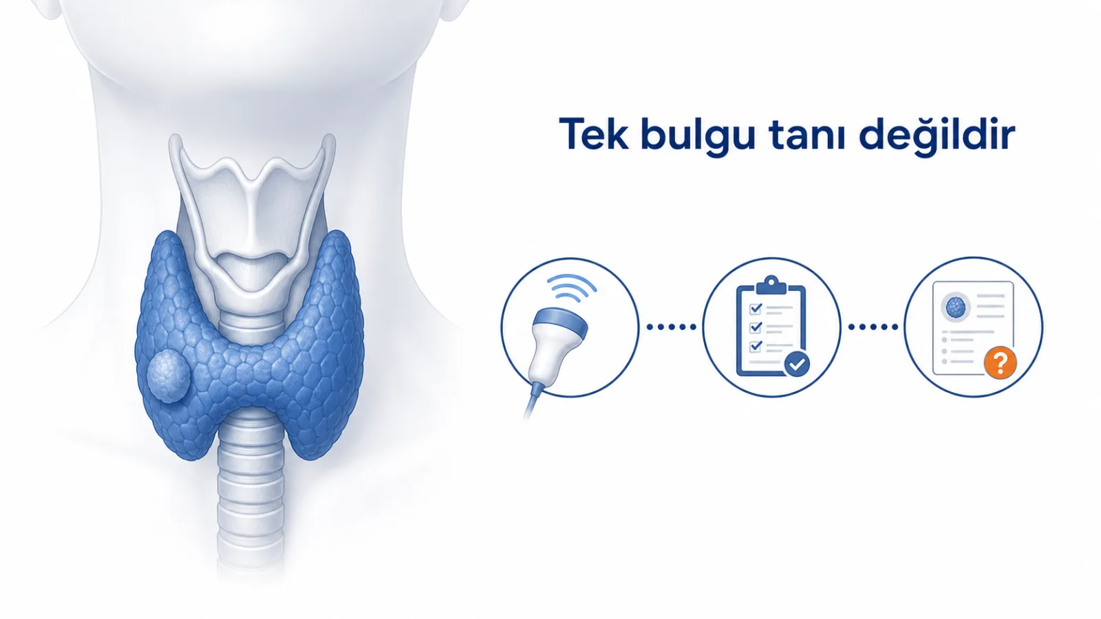 Tiroid bezindeki nodülün ultrason ve raporla birlikte değerlendirilmesini gösteren hasta dostu anatomik şema