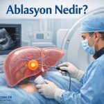 karaciğer ablasyon tedavisi