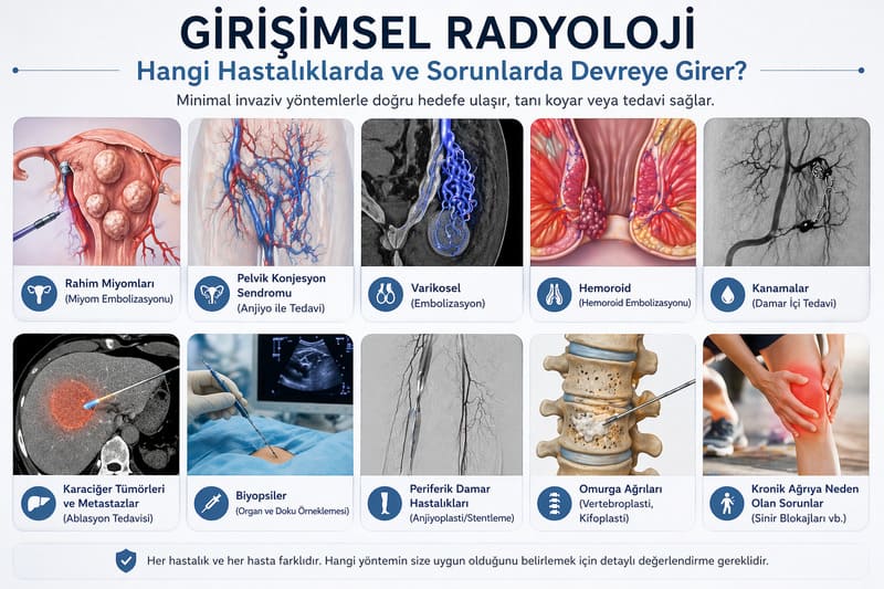 Girişimsel Radyoloji Hangi Hastalıkları Tedavi Eder Girişimsel Radyoloji Hangi Hastalıkları Tedavi Eder