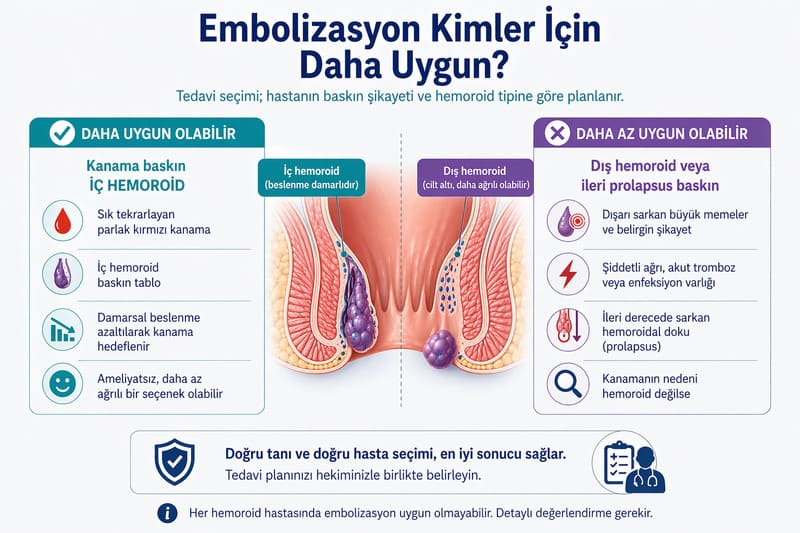 hemoroid embolizasyonu kimlere uygun