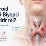 her tiroid nodulune biyopsi gerekirmi