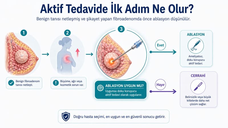 meme fibroadenom aktif tedavi