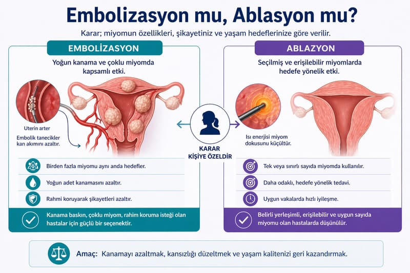 miyom embolizasyon vs ablasyon