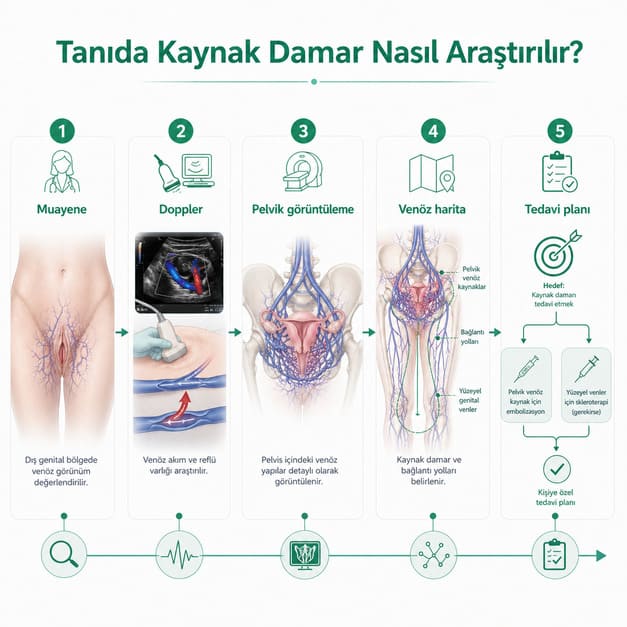 genital varis pelvik konjesyon tanisi