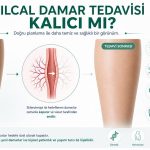 klical varis tedavisi kalicimi
