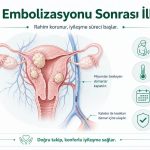 miyom embolizasyonu ilk gun