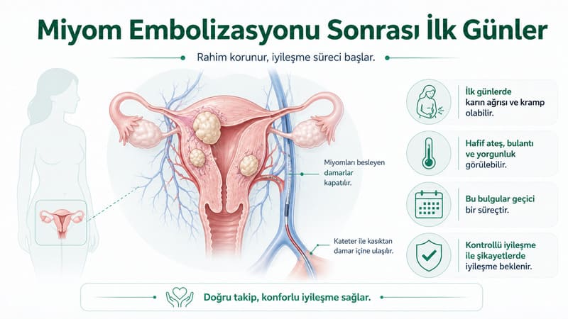 miyom embolizasyonu ilk gun