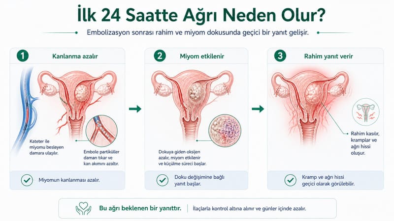 miyom embolizasyonu ilk24 saat