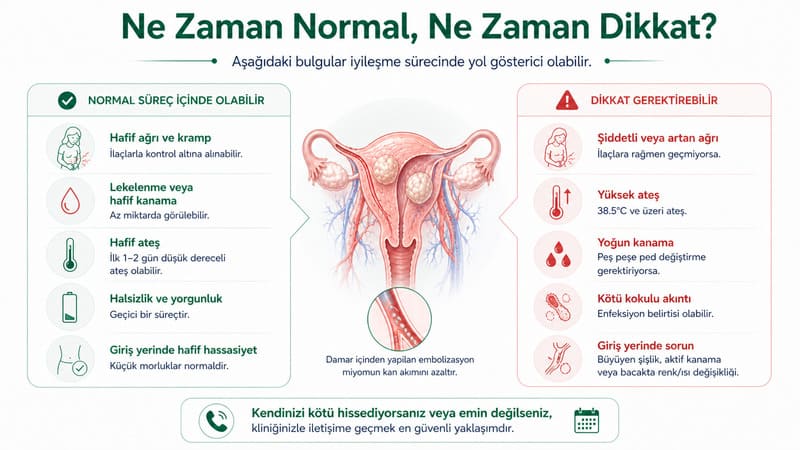 miyom embolizasyonu surec
