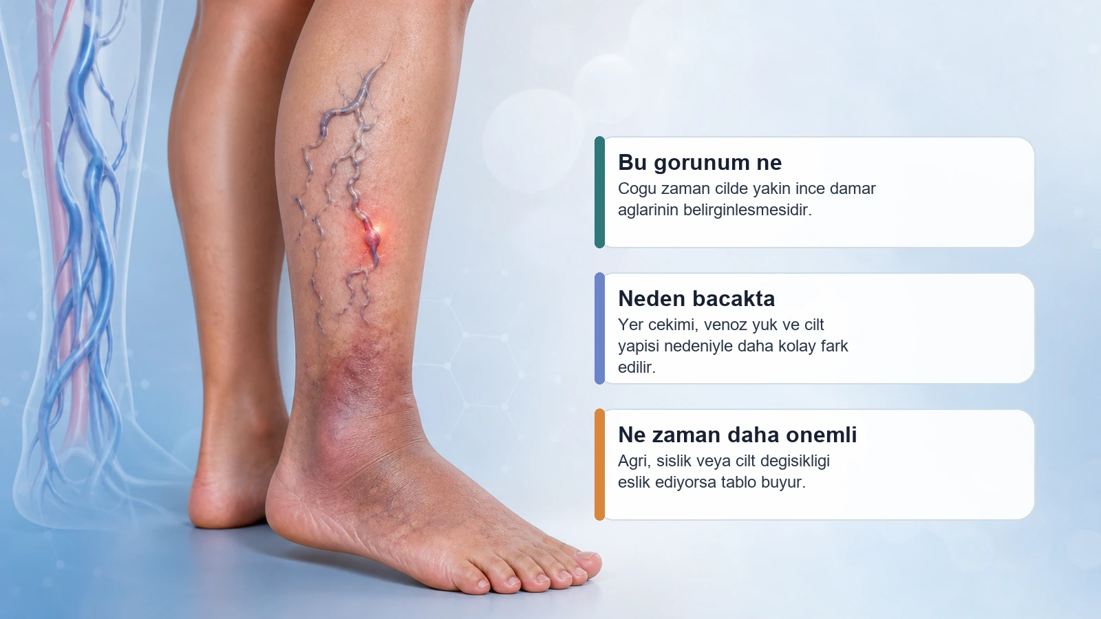 Bacakta ince mor-kirmizi damar aglarinin neden daha gorunur hale geldigini anlatan sematik medikal gorsel