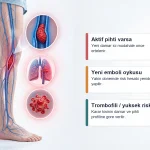 Kopuk tedavisinde pihti riski gorseli Aktif derin ven trombozu, yeni emboli oykusu ve pihtilasma riski bulunan hastalarda kopuk tedavisi kararini anlatan egitici gorsel.