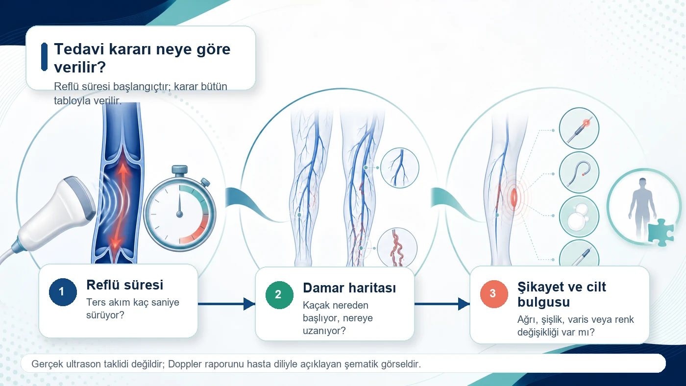 Reflü süresi, damar haritası ve şikayetlerin tedavi kararında birlikte değerlendirildiğini gösteren görsel