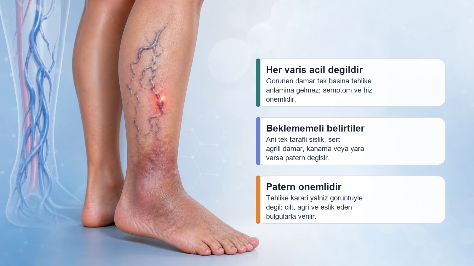 Variste hangi belirtilerin daha ciddi degerlendirme gerektirebilecegini anlatan sematik bacak gorseli