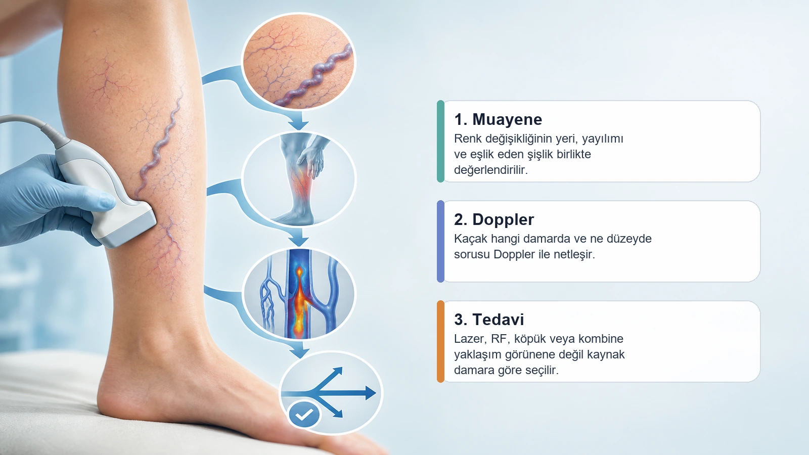 Variste cilt değişikliğinden Doppler değerlendirmesine ve tedavi kararına giden akışı açıklayan premium medikal görsel