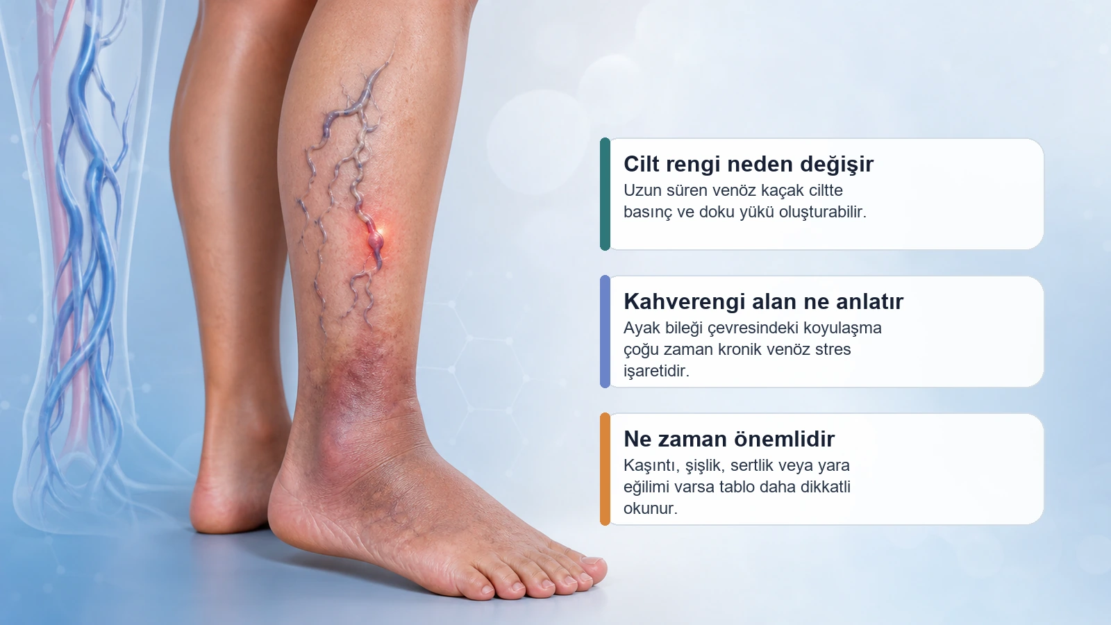 Variste ayak bileği çevresinde renk değişikliği ve yüzeyel damar yükünü açıklayan premium medikal görsel