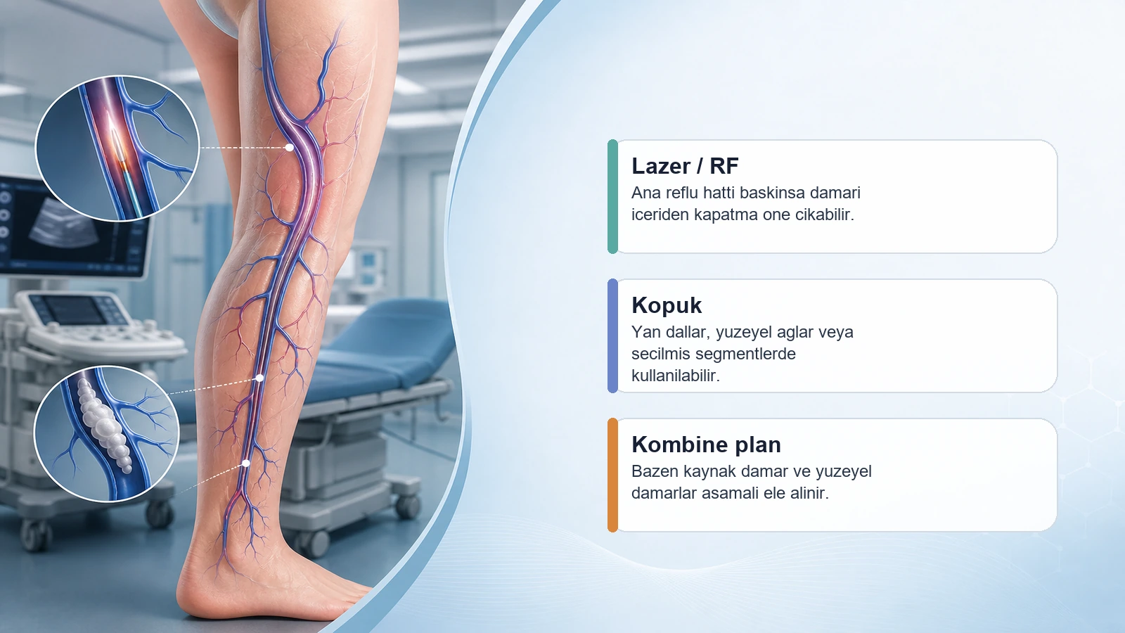Venöz Reflü Nedir, Nasıl Tedavi Edilir? için Doppler haritalama, tedavi plani ve kan akiminin yonlenmesini açıklayan premium medikal görsel